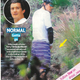 Image for article titled This Week In Tabloids: Heidi Montag Shows Us Her Scars